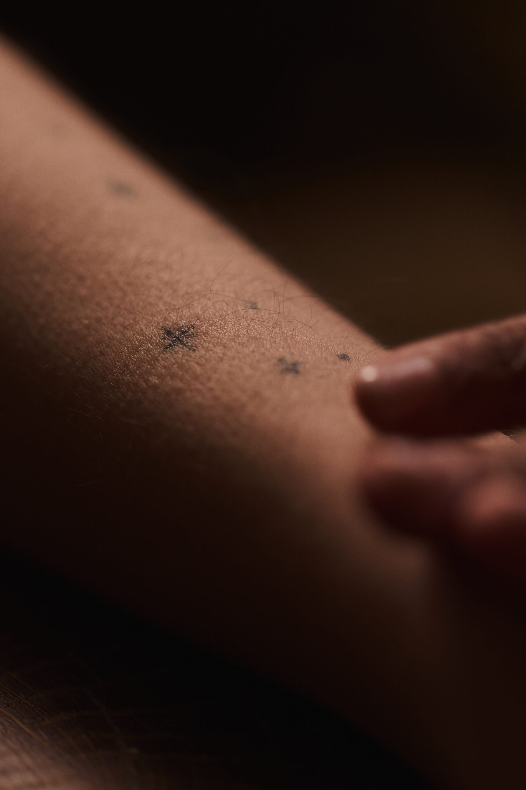 Close-up of a forearm. A hand gently touches the arm, in preparation for an acupuncture treament. Dim, warm lighting.